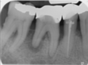 Multi-disciplinary treatment - Pre-operative X-ray